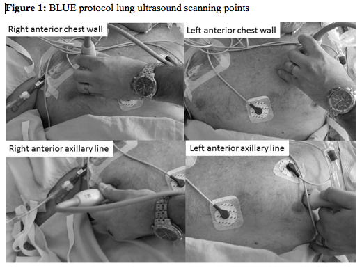 BLUE Lung Protocol