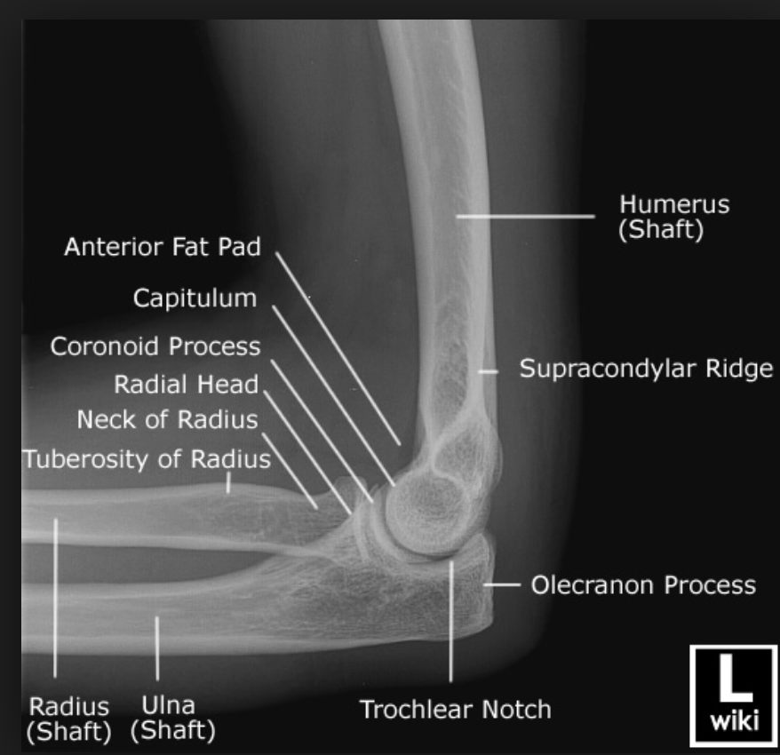 X-ray of Normal Elbow Anatomy