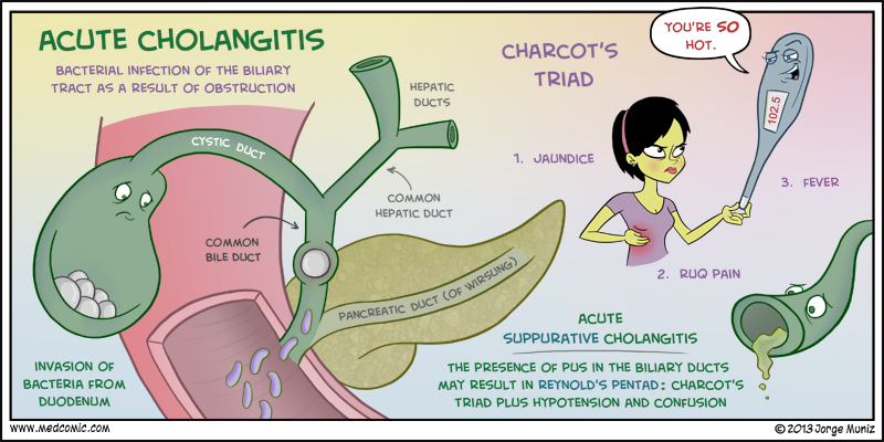 Acute Cholangitis Infographic (mediconet.blogspot.com)