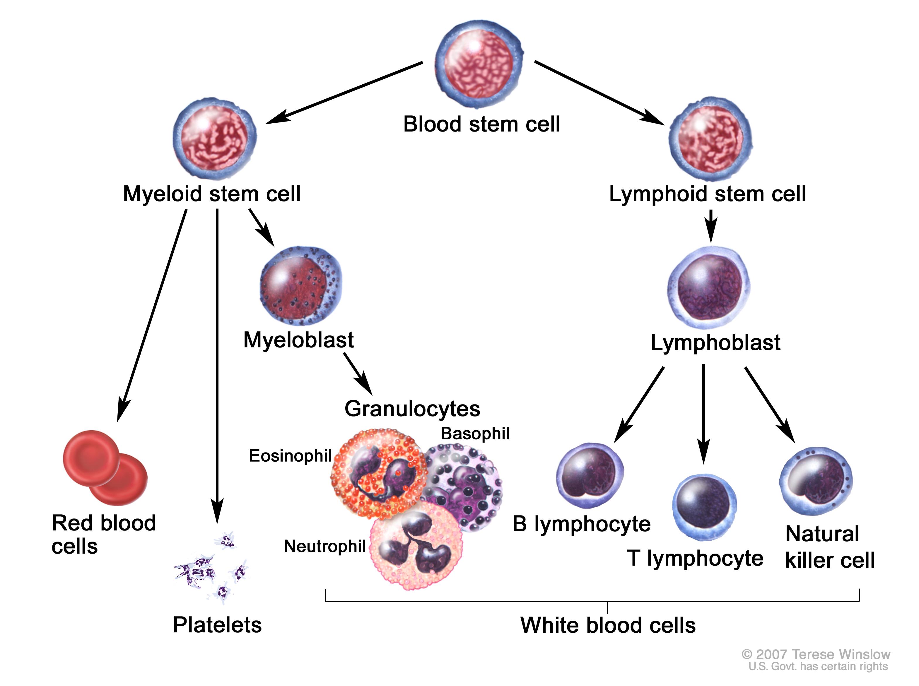 Myelogenous Leukemia (National Cancer Institute www.cancer.gov)