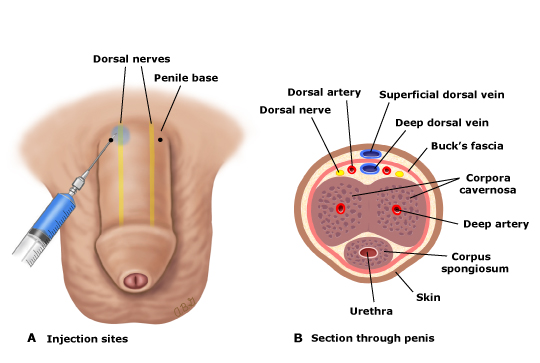 Dorsal Nerve Of Penis 61