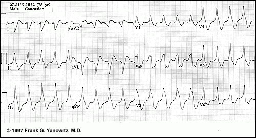 Rhythm Collision - Collision Course Rhythm Collision - Collision Course