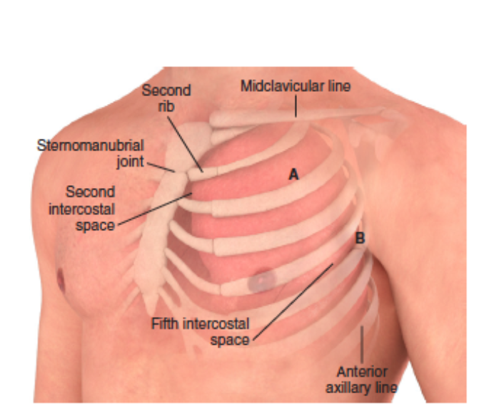 Chest Wall Anatomy - Roberts + Hedges
