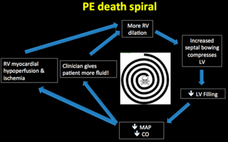 PE Death Spiral