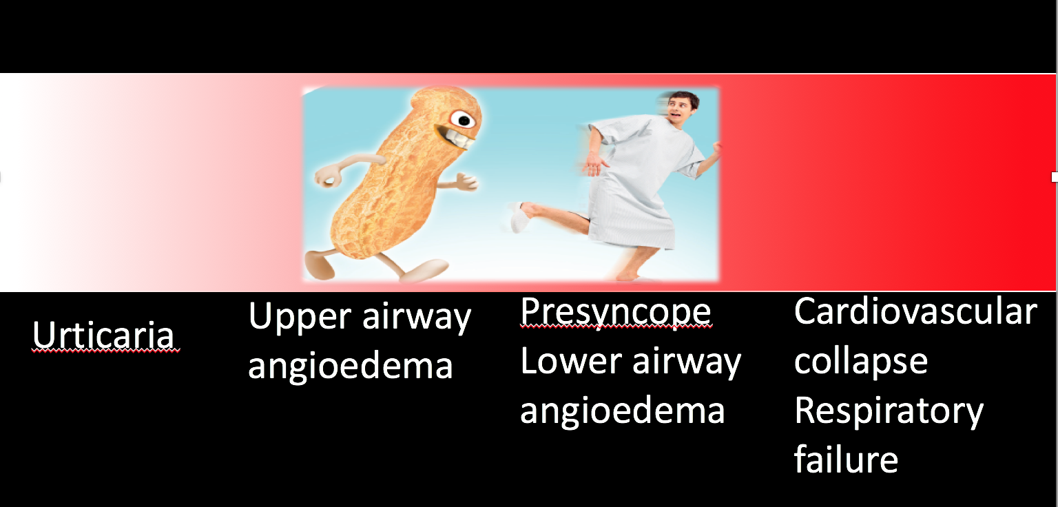 Anaphylaxis Spectrum of Disease