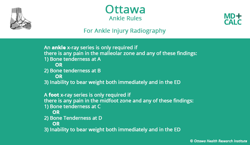 Ottawa Ankle Rule 2 - MDCalc