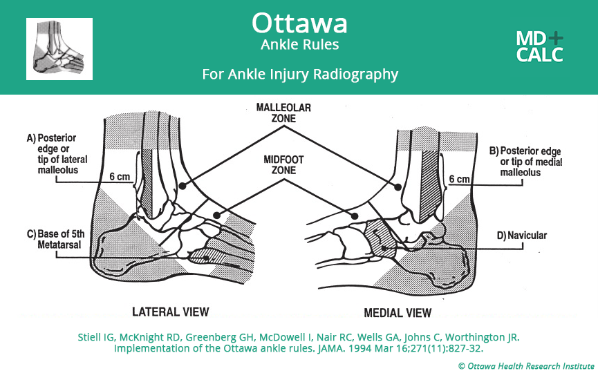 Ottawa Ankle Clinical Decision Instrument Derivation Study – Core EM