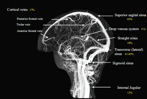 MRV of the Cerebral Venous System (Saposnik 2011)