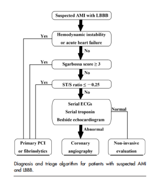 Diagnostic Algorithm for Suspected in AMI in LBBB (Cai 2013)