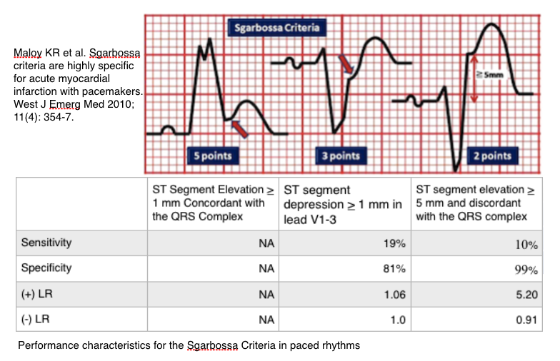 bundle branch block measurement