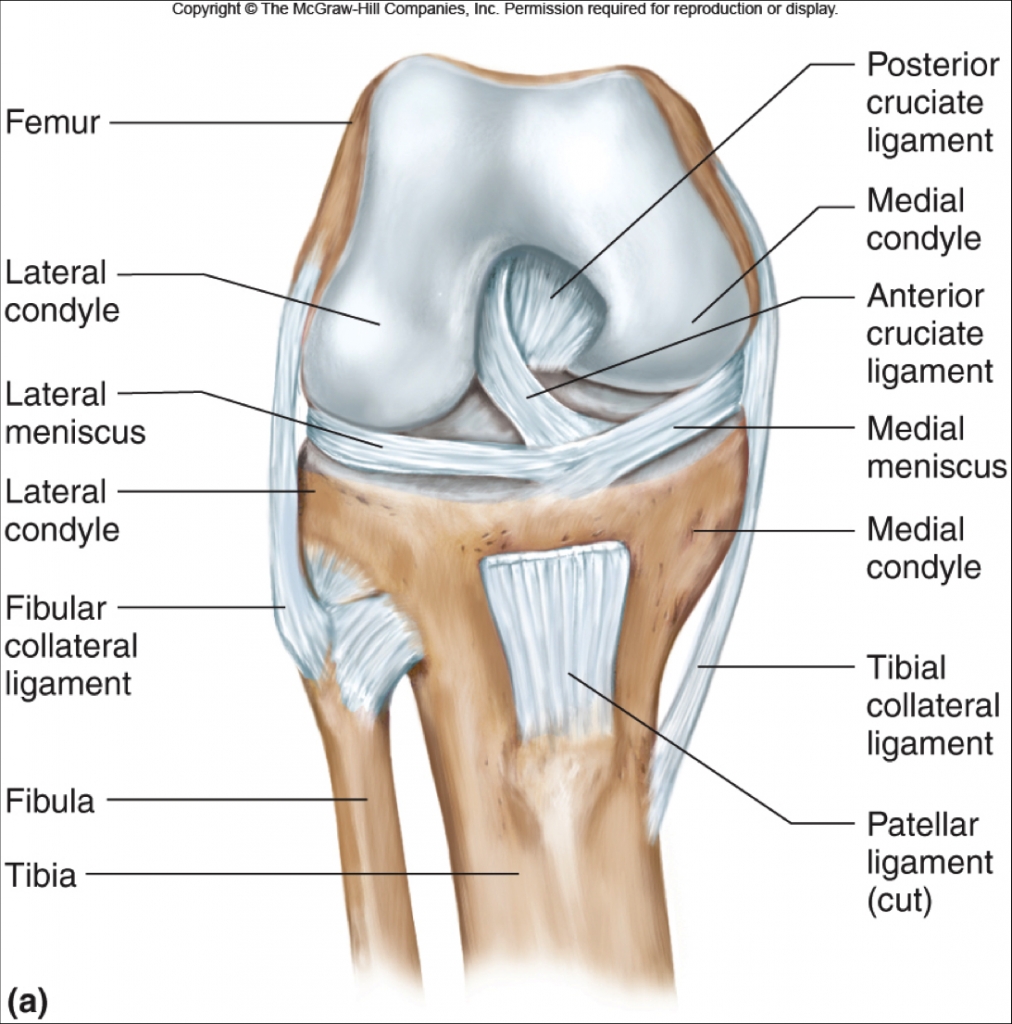 ACL Tear - Knee & Sports - Orthobullets