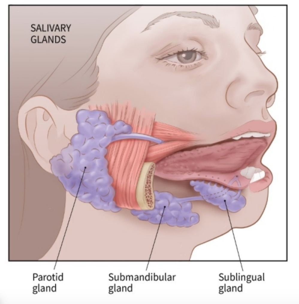 parotid gland swelling differential diagnosis