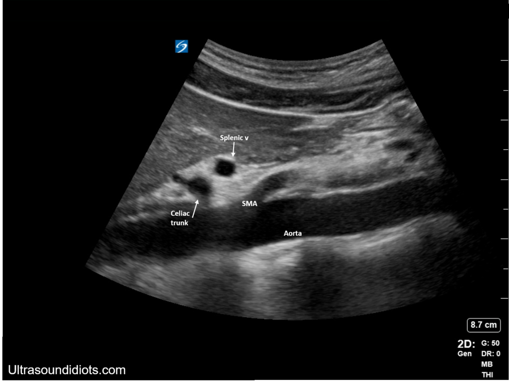 Abdominal Aortic Ultrasound Core Em