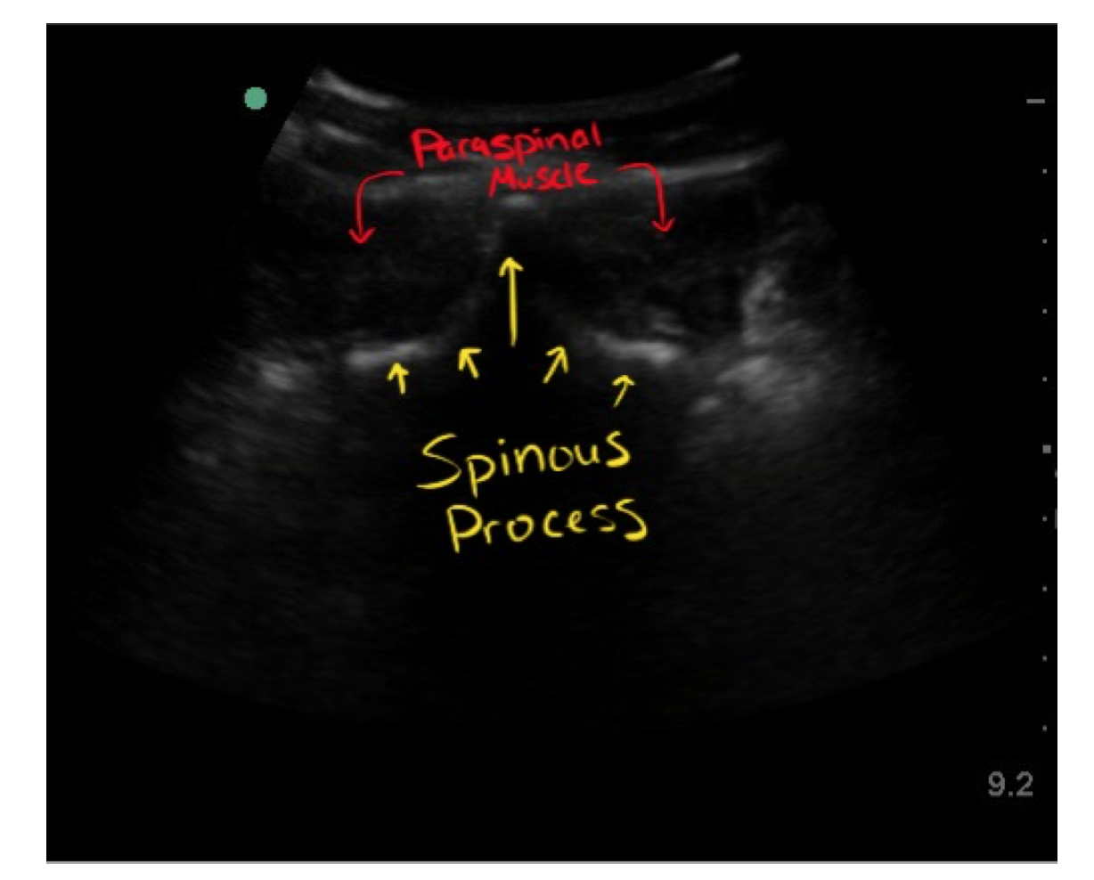 curvilinear probe ultrasound slide