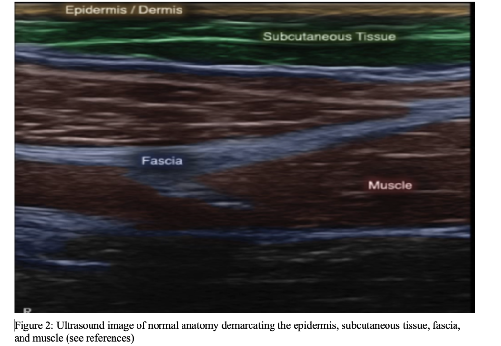 Soft Tissue Ultrasound 